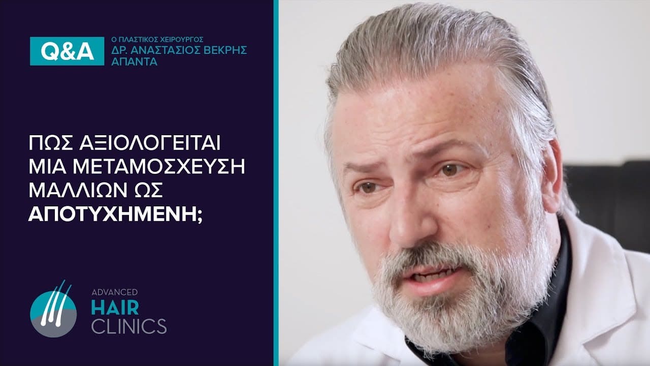 ΔΕΙΤΕ ΑΠΟΤΥΧΙΑ Σε Μεταμόσχευση Μαλλιών;;; #advancedhairclinics