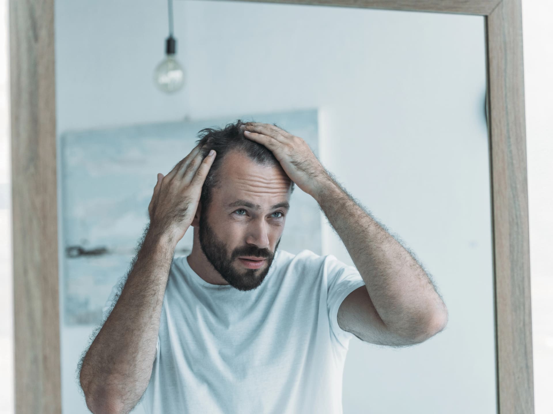 Ποια είναι η καλύτερη ηλικία για μεταμόσχευση μαλλιών