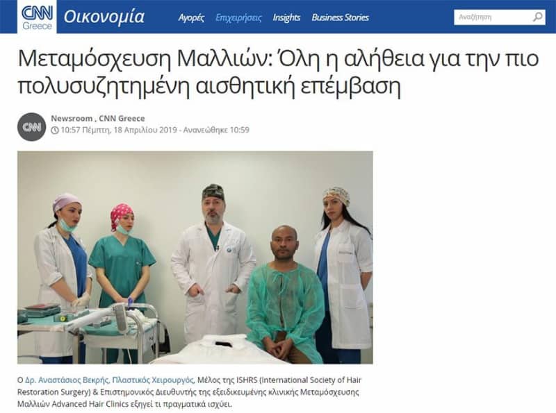 Μεταμόσχευση Μαλλιών: Όλη η αλήθεια για την πιο πολυσυζητημένη αισθητική επέμβαση