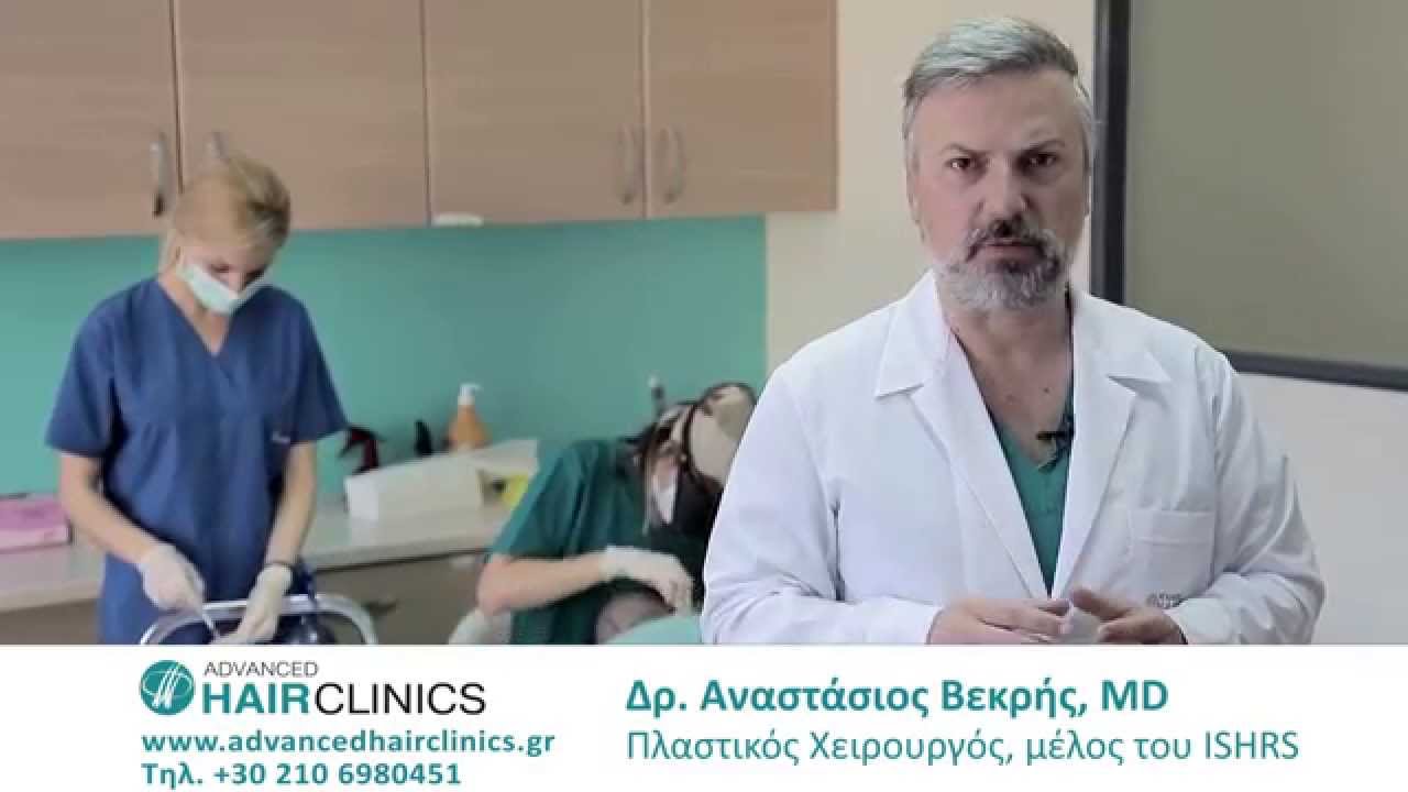 Ακούρευτη Συνεδρία Μεταμόσχευσης Μαλλιών (unshaven fue)