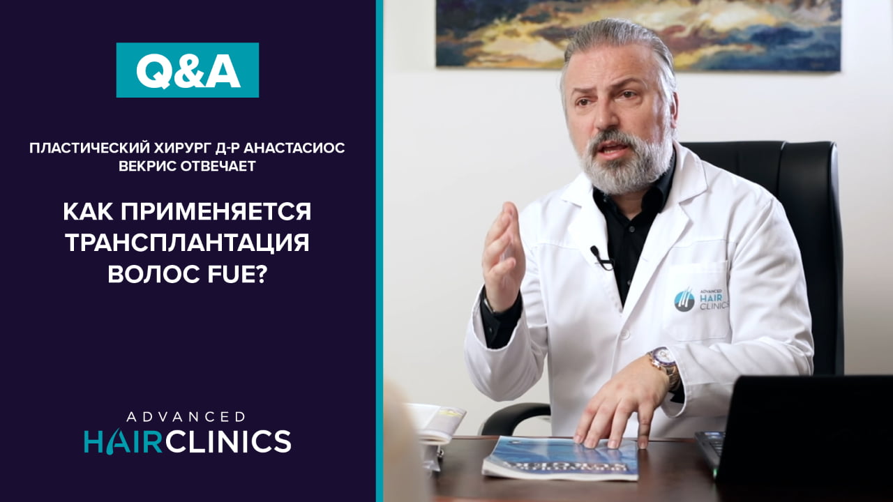 Пересадка волос по методу ЭФЕ — как это работает
