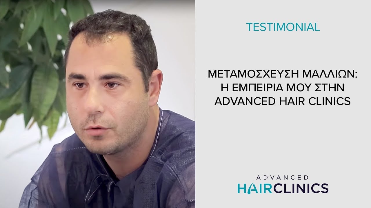 Μεταμόσχευση Μαλλιών | H εμπειρία μου στην Advanced Hair Clinics