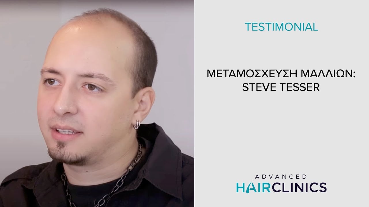 Μεταμόσχευση Μαλλιών - 🎸Steve Tesser🎸 | Advanced Hair Clinics